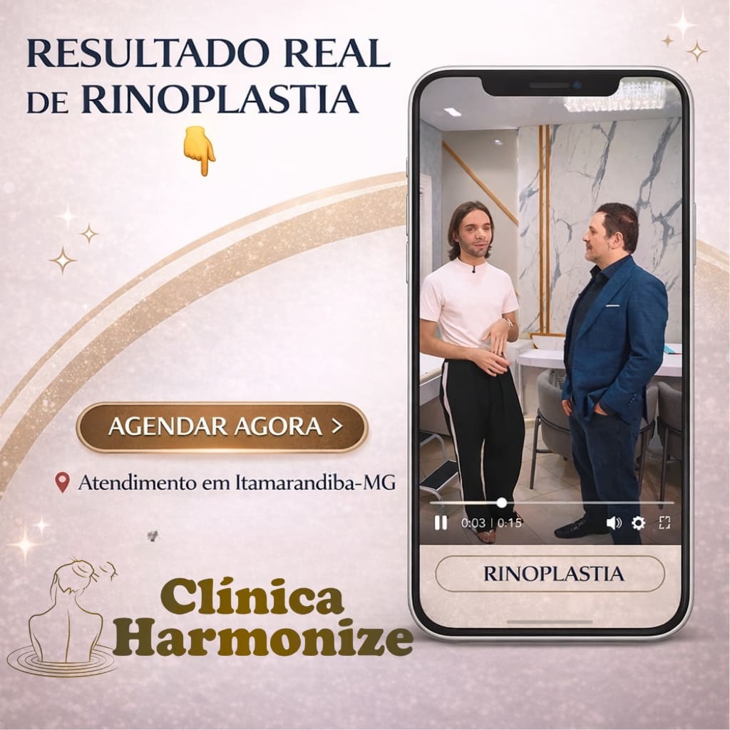 Resultado de Rinoplastia